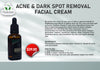 acne and dark spot removal facial cream